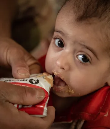 Arwa Al-Oshari, 14 month old, who is suffering from malnutrition, being given the prescribed supplements to help her