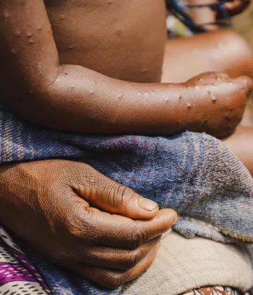 ©UNICEF/UNI624811/Benekire