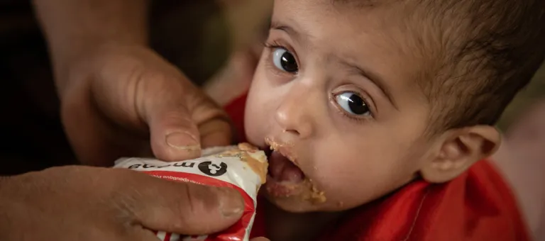 Arwa Al-Oshari, 14 month old, who is suffering from malnutrition, being given the prescribed supplements to help her